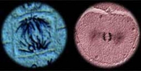 plant and animal cell microscope pictures of chromosomes at anaphase of mitosis