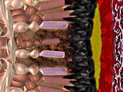 in dry macular degeneration drusen accumulate underneath the photoreceptors in the retina and macula