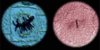 plant and animal cell microscope pictures of sister chromatids at metaphase of mitosis