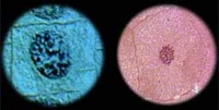 plant and animal cell microscope pictures of prophase or prometaphase of mitosis